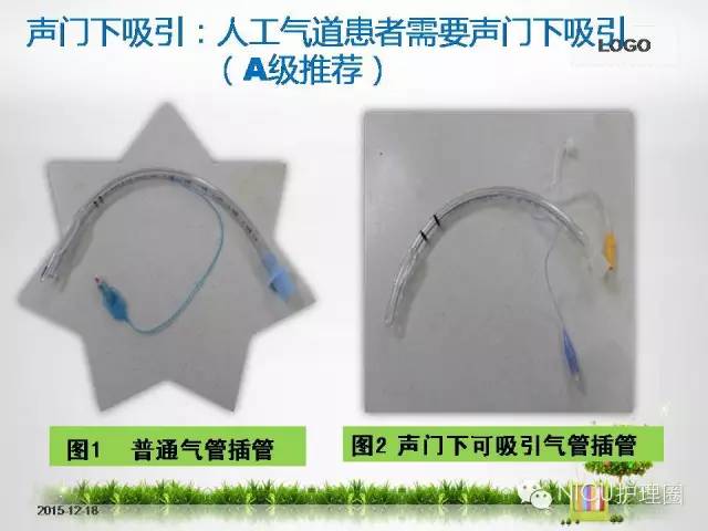 科技重塑急救，最新氣管插管視頻，體驗(yàn)未來醫(yī)療的魅力