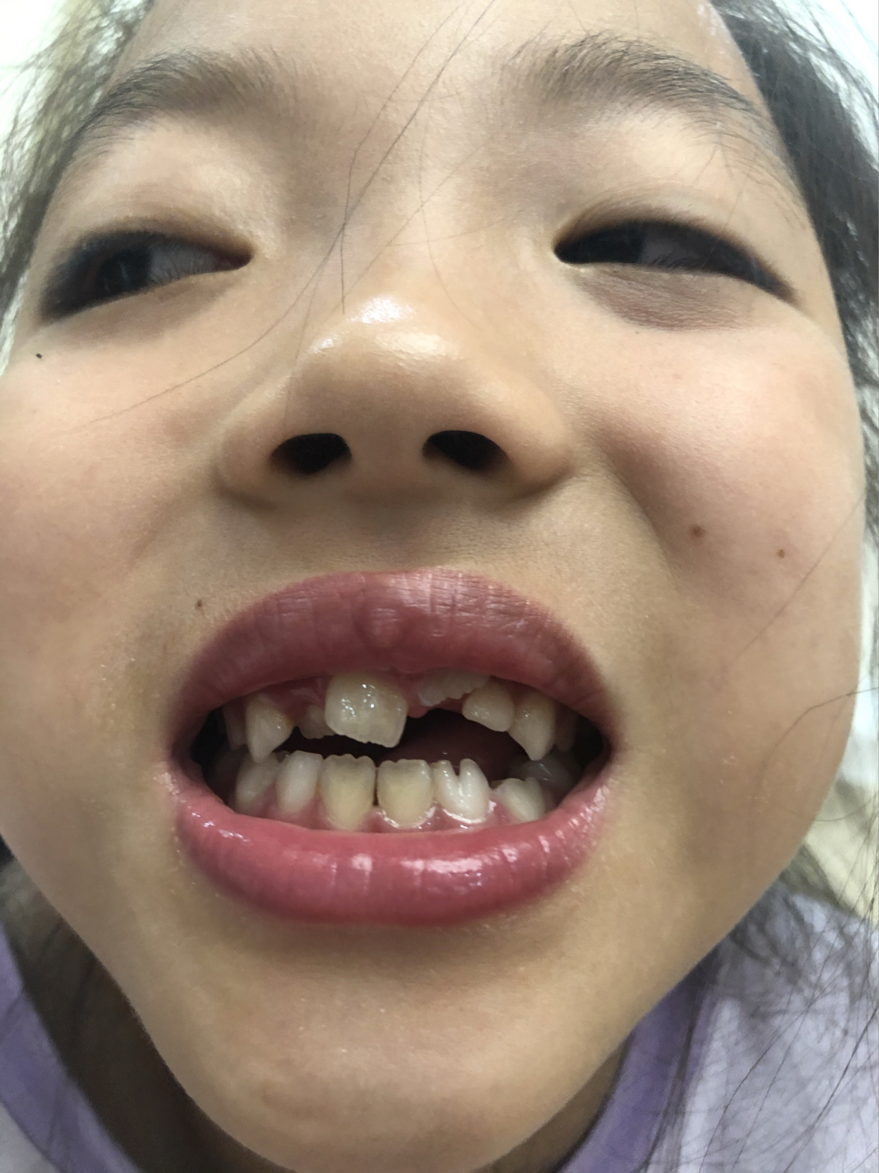 莊最新牙齒技術(shù)揭秘，牙齒美容新選擇